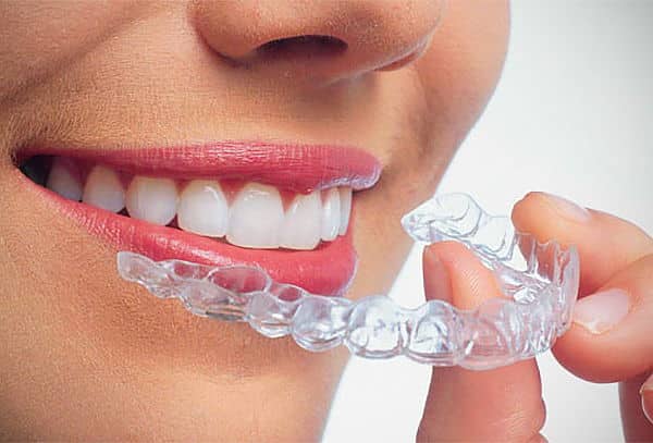 a girl holding her mouthguard