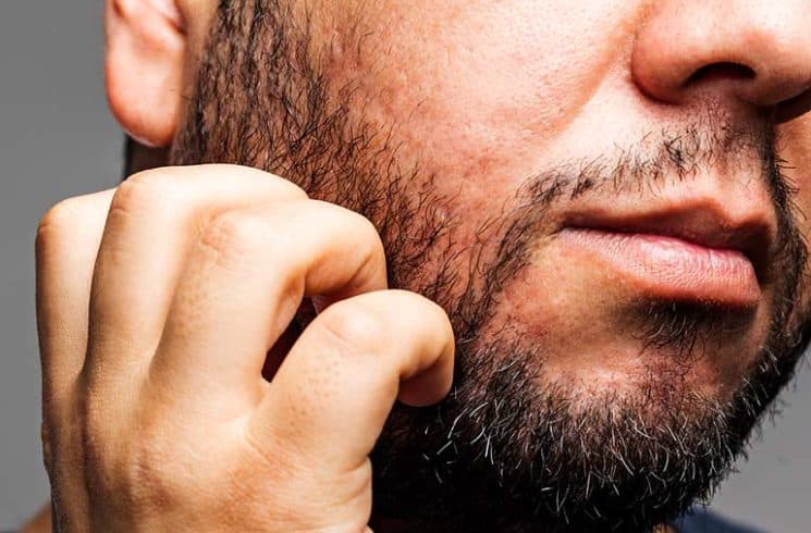 Man itching his bearded face